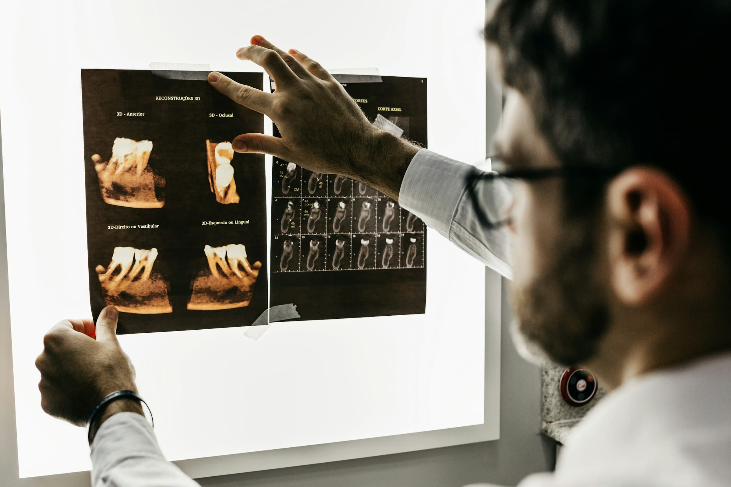 طب أسنان الأطفال