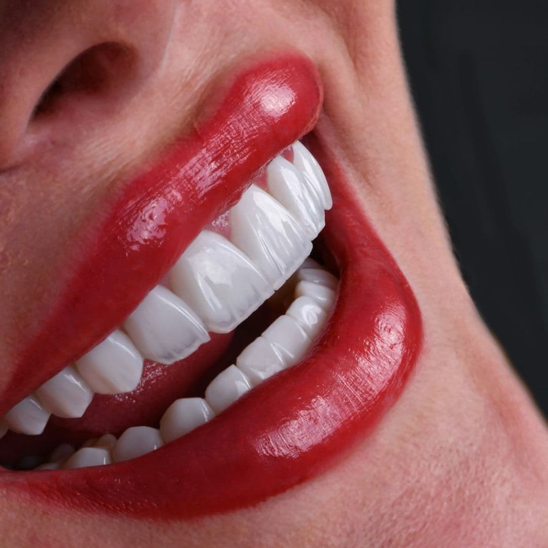 Dental Treatments