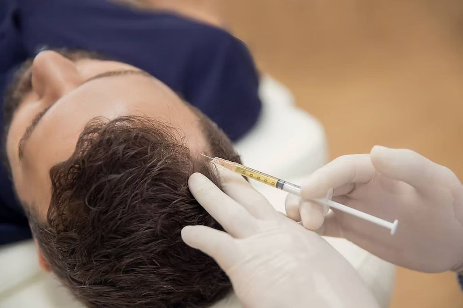 Mesotherapy Hair Treatment in Dubai