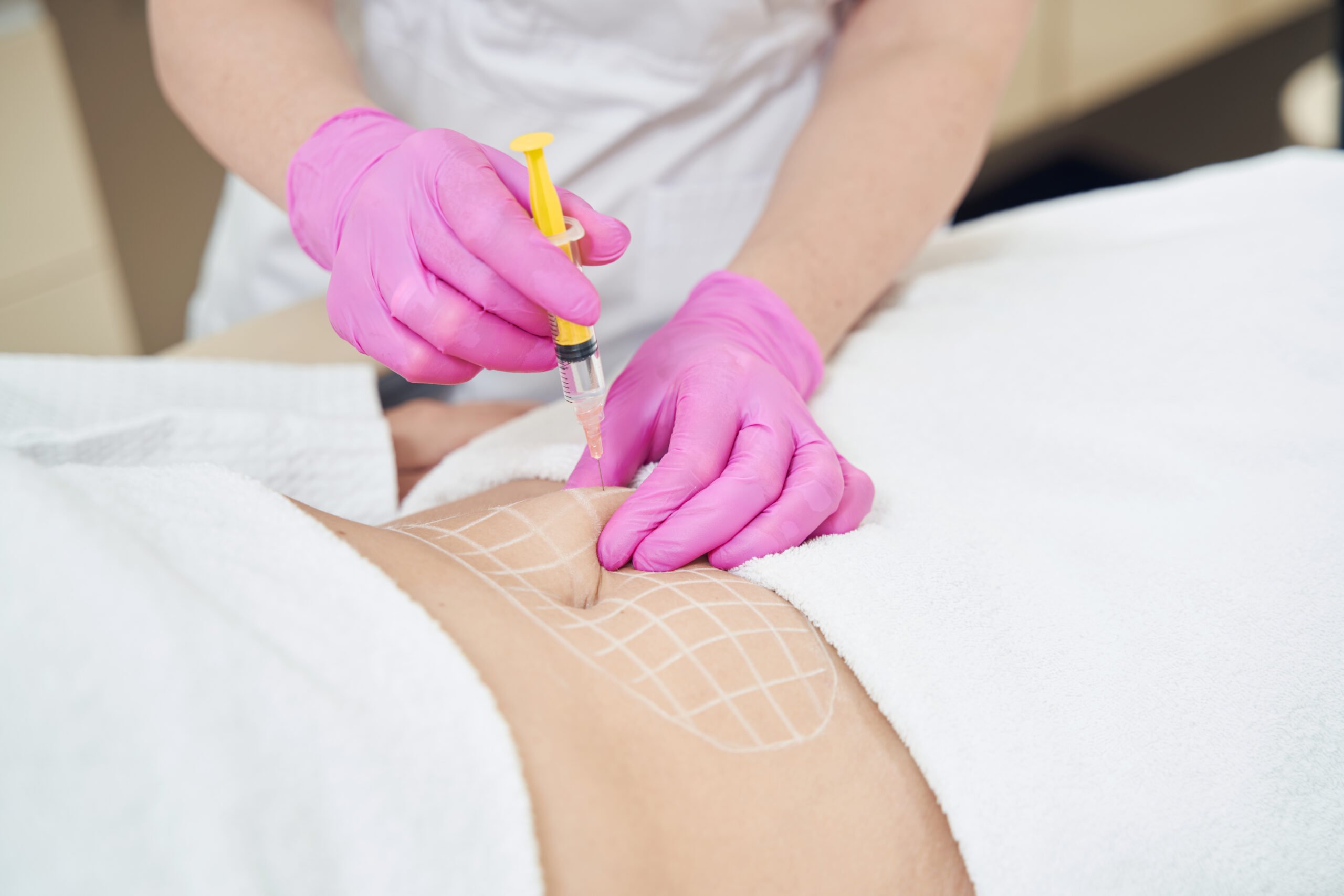 <a href="https://kaylamedicalcenter.com/ar/%d8%ae%d8%af%d9%85%d8%a7%d8%aa%d9%86%d8%a7/%d8%a7%d9%84%d8%aa%d8%ae%d8%b3%d9%8a%d8%b3/">التخسيس</a>